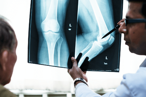 living-with-arthritis